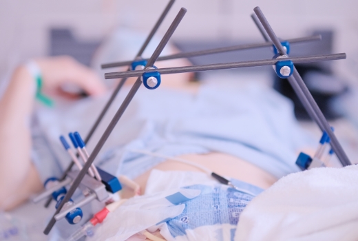 Acute Care Surgery